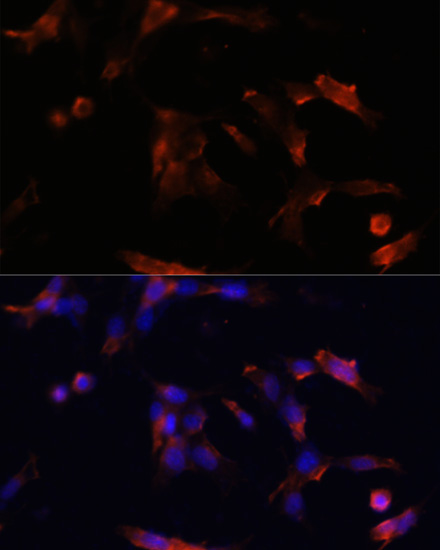 Immunofluorescence - AQP5 Polyclonal Antibody 