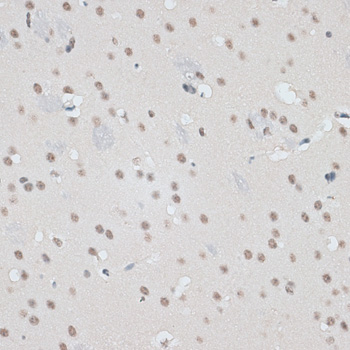 Immunohistochemistry - RBM17 Polyclonal Antibody 