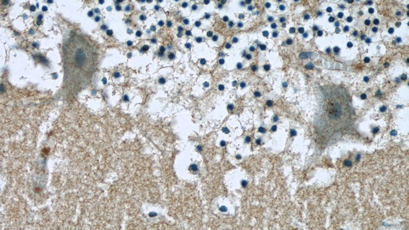 Immunohistochemistry of paraffin-embedded human cerebellum slide using Catalog No:110076(DMXL2 Antibody) at dilution of 1:50