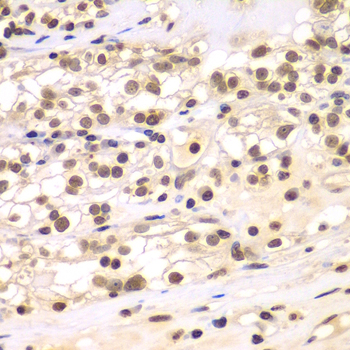 Immunohistochemistry - ULK4 Polyclonal Antibody 