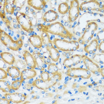 Immunohistochemistry - APOBEC3F Polyclonal Antibody 