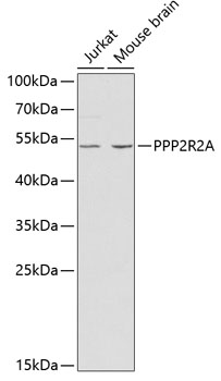 Western blot - PPP2R2A Polyclonal Antibody 