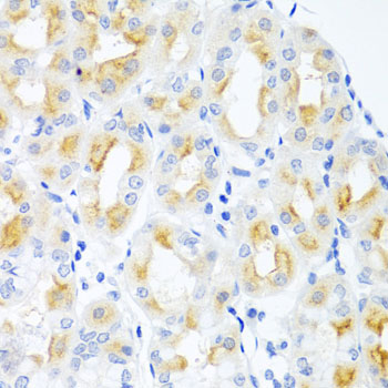Immunohistochemistry - CGB Polyclonal Antibody 