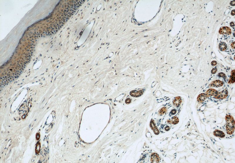 Immunohistochemical of paraffin-embedded human skin using Catalog No:116762(VMA21 antibody) at dilution of 1:50 (under 10x lens)