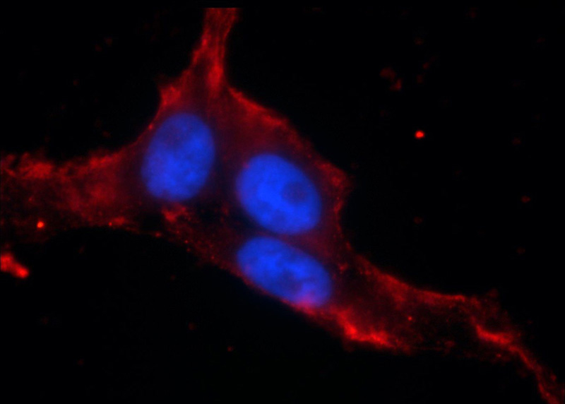 Immunofluorescent analysis of SH-SY5Y cells using Catalog No:108103(ANO8 Antibody) at dilution of 1:25 and Rhodamine-Goat anti-Rabbit IgG