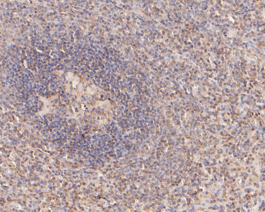 Fig6:; Immunohistochemical analysis of paraffin-embedded human spleen tissue using anti-IL-7 antibody. The section was pre-treated using heat mediated antigen retrieval with Tris-EDTA buffer (pH 9.0) for 20 minutes.The tissues were blocked in 5% BSA for 30 minutes at room temperature, washed with ddH; 2; O and PBS, and then probed with the primary antibody ( 1/500) for 30 minutes at room temperature. The detection was performed using an HRP conjugated compact polymer system. DAB was used as the chromogen. Tissues were counterstained with hematoxylin and mounted with DPX.