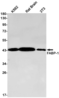 Western blot detection of FABP-1 in K562,Rat Brain,3T3 cell lysates using FABP-1 Rabbit pAb(1:1000 diluted).Predicted band size:48kDa.Observed band size:45kDa.