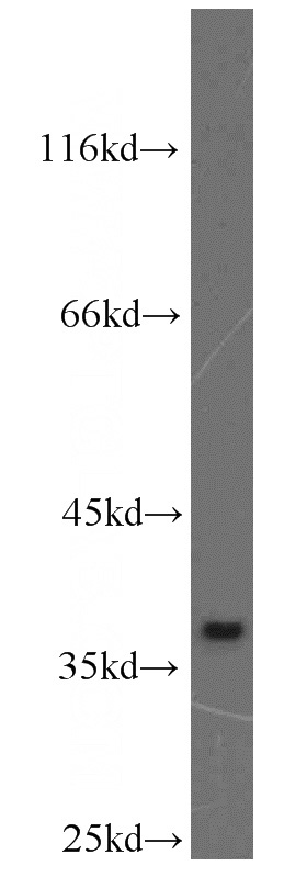 HepG2 cells were subjected to SDS PAGE followed by western blot with Catalog No:112494(MAT2B antibody) at dilution of 1:800