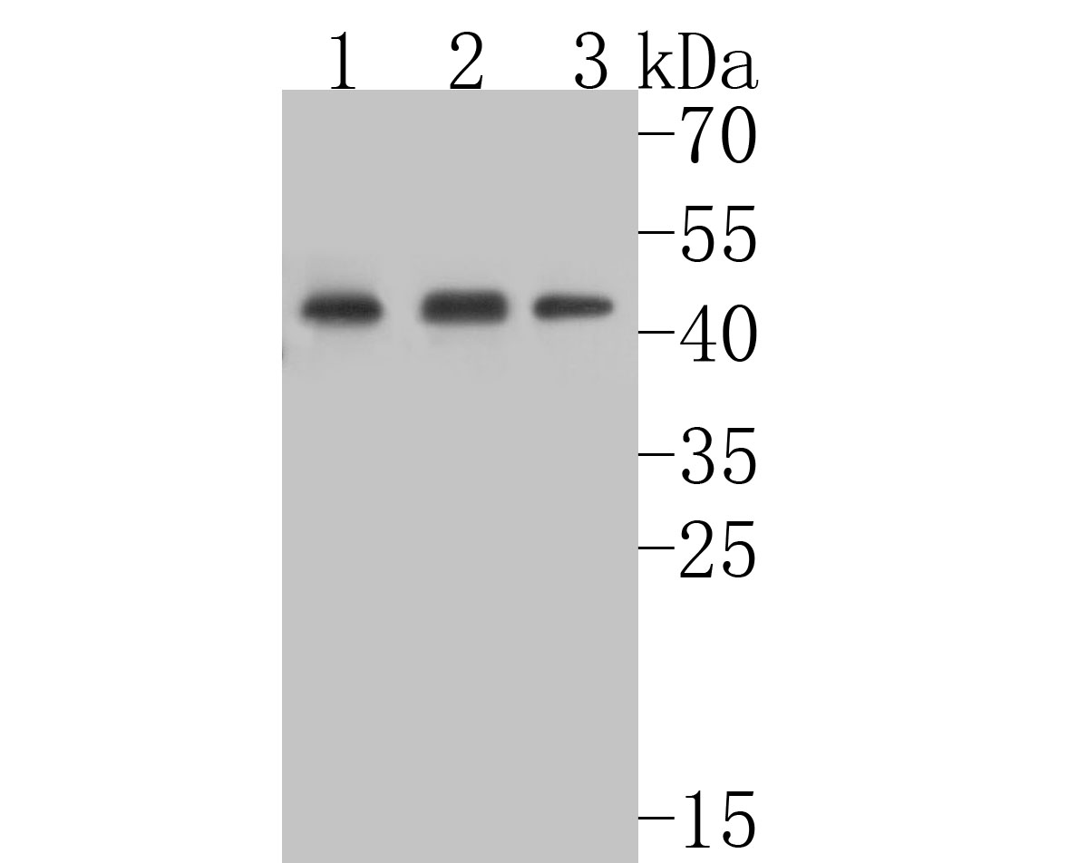 Fig1:; Western blot analysis of TNFRSF19 on different lysates. Proteins were transferred to a PVDF membrane and blocked with 5% BSA in PBS for 1 hour at room temperature. The primary antibody ( 1/500) was used in 5% BSA at room temperature for 2 hours. Goat Anti-Rabbit IgG - HRP Secondary Antibody (HA1001) at 1:5,000 dilution was used for 1 hour at room temperature.; Positive control:; Lane 1: mouse testis tissue lysate; Lane 2: rat large intestine tissue lysate; Lane 3: A431 cell lysate