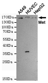 Western blot analysis of extracts from A549,HUVEC and HepG2 cells using Met (Ab-1234) rabbit pAb (1:1000 diluted).Predicted band size:156KDa.Observed band size:156KDa.