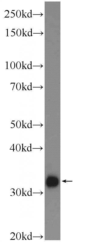 rat skeletal muscle tissue were subjected to SDS PAGE followed by western blot with Catalog No:112998(MYOZ3 Antibody) at dilution of 1:1000