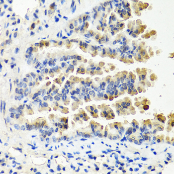 Immunohistochemistry - NTF3 Polyclonal Antibody 