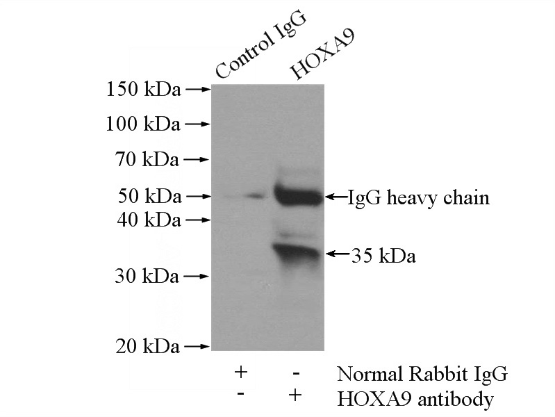 IP Result of anti-HOXA9 (IP:Catalog No:111530, 3ug; Detection:Catalog No:111530 1:300) with mouse appendix tissue lysate 4000ug.