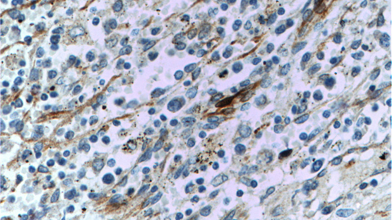 Immunohistochemistry of paraffin-embedded human spleen tissue slide using Catalog No:116725(VCAM-1 Antibody) at dilution of 1:50 (under 40x lens)