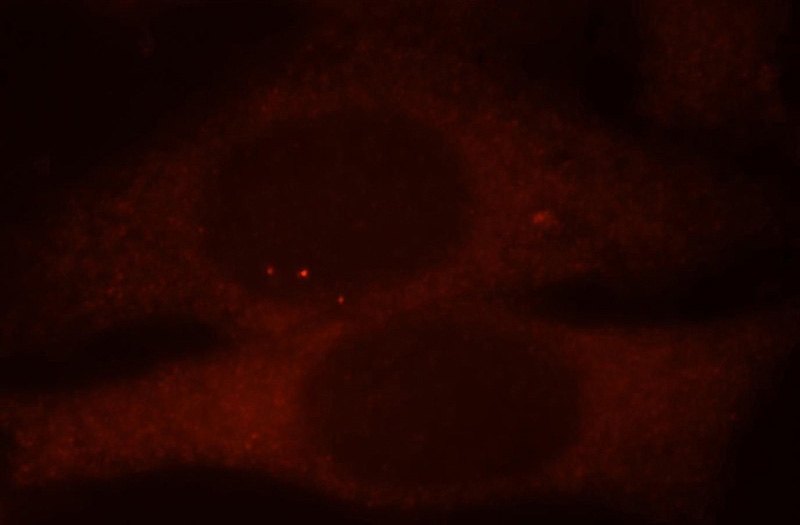 Immunofluorescent analysis of HepG2 cells, using MDH1 antibody Catalog No:112568 at 1:25 dilution and Rhodamine-labeled goat anti-rabbit IgG (red).