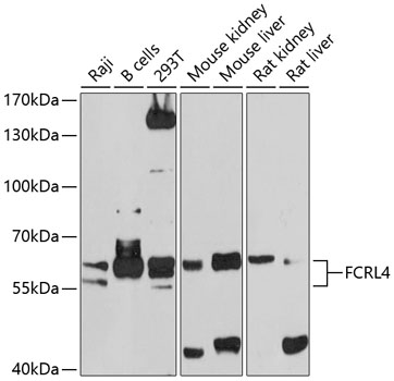 Western blot - FCRL4 Polyclonal Antibody 