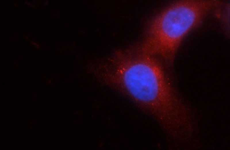 Immunofluorescent analysis of SH-SY5Y cells using Catalog No:116410(TRPM1 Antibody) at dilution of 1:25 and Rhodamine-Goat anti-Rabbit IgG