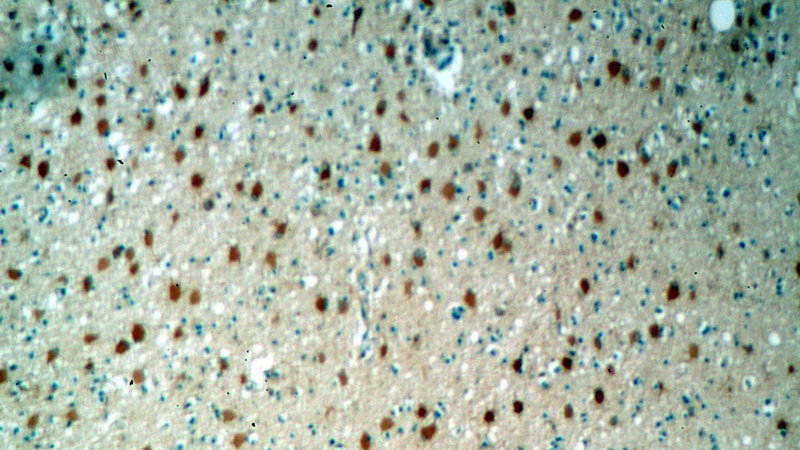 Immunohistochemical of paraffin-embedded human brain using Catalog No:111384(HDDC2 antibody) at dilution of 1:100 (under 10x lens)