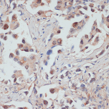 Immunohistochemistry - TES Polyclonal Antibody 