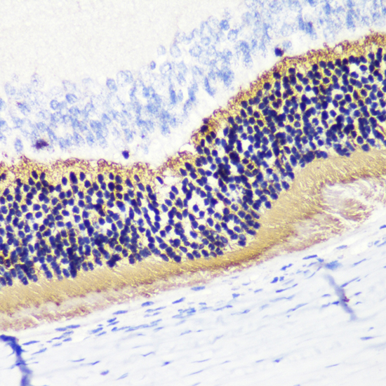 Immunohistochemistry - PDC Polyclonal Antibody 