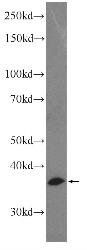 mouse brain tissue were subjected to SDS PAGE followed by western blot with Catalog No:115285(SIAH2 Antibody) at dilution of 1:300