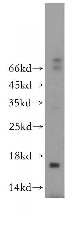 human liver tissue were subjected to SDS PAGE followed by western blot with Catalog No:109551(CREBL2 antibody) at dilution of 1:500
