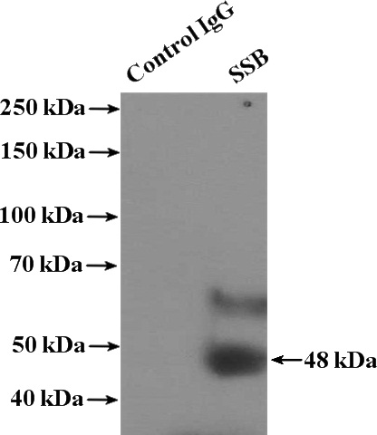 IP Result of anti-SSB (IP:Catalog No:115605, 4ug; Detection:Catalog No:115605 1:300) with Jurkat cells lysate 3600ug.