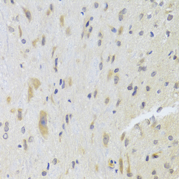 Immunohistochemistry - DPP3 Polyclonal Antibody 