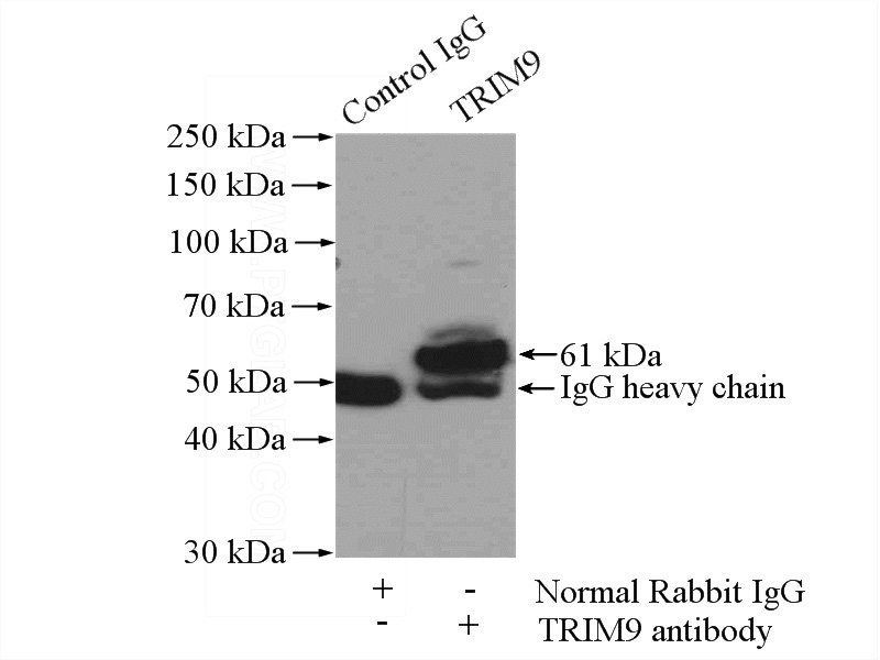 IP Result of anti-TRIM9 (IP:Catalog No:116325, 4ug; Detection:Catalog No:116325 1:1000) with mouse brain tissue lysate 4000ug.