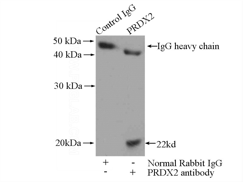 IP Result of anti-RAB5A (IP:Catalog No:114453, 4ug; Detection:Catalog No:114453 1:500) with mouse brain tissue lysate 4000ug.