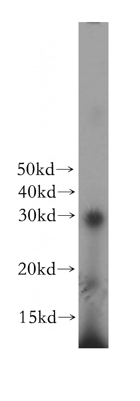 MCF7 cells were subjected to SDS PAGE followed by western blot with Catalog No:109750(DCK antibody) at dilution of 1:1000