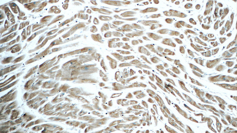 Immunohistochemistry of paraffin-embedded human heart tissue slide using Catalog No:111955(ITPA Antibody) at dilution of 1:50 (under 10x lens)