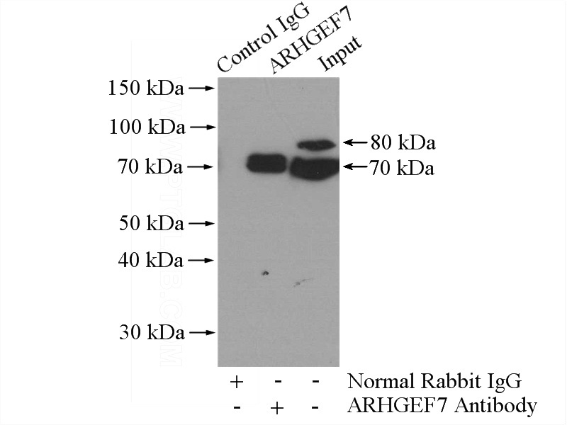 IP Result of anti-ARHGEF7 (IP:Catalog No:108189, 4ug; Detection:Catalog No:108189 1:1000) with HeLa cells lysate 1200ug.
