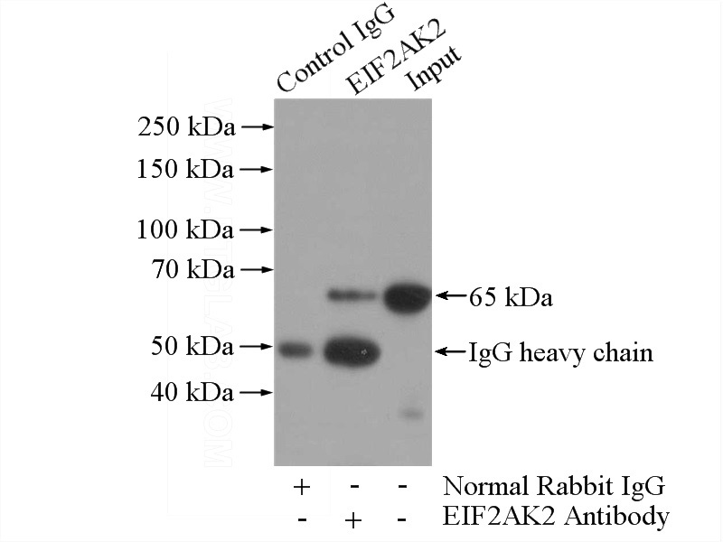 IP Result of anti-EIF2AK2 (IP:Catalog No:110180, 4ug; Detection:Catalog No:110180 1:500) with HeLa cells lysate 1200ug.
