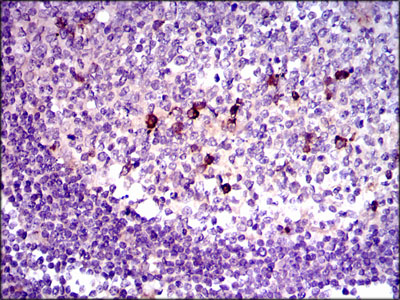 Immunohistochemical analysis of paraffin-embedded lymphoid tissue tissues using TGFb1 mouse mAb with DAB staining.