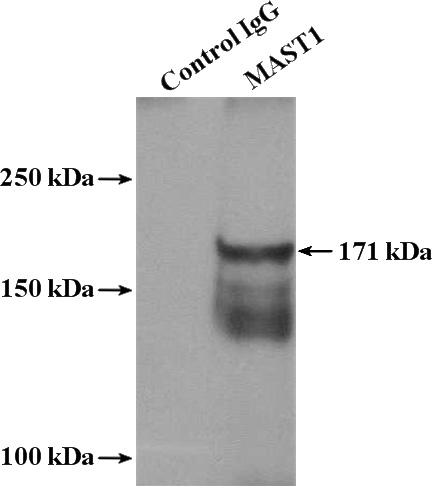 IP Result of anti-MAST1 (IP:Catalog No:112490, 4ug; Detection:Catalog No:112490 1:500) with mouse brain tissue lysate 4000ug.