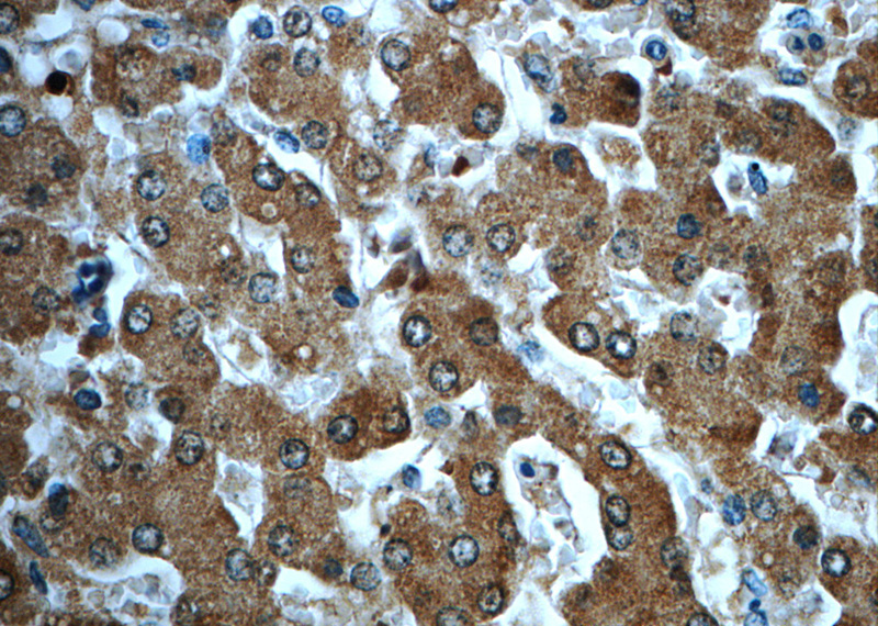 Immunohistochemistry of paraffin-embedded human liver slide using Catalog No:107790(ADH7 Antibody) at dilution of 1:50