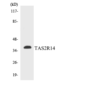 Fig1:; Western blot analysis of lysates from MCF-7 cells, using TAS2R14 Antibody. The lane on the right is blocked with the synthesized peptide.