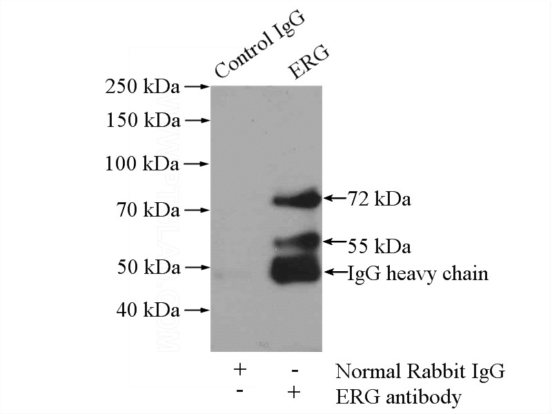 IP Result of anti-ERG (IP:Catalog No:110355, 4ug; Detection:Catalog No:110355 1:500) with MCF-7 cells lysate 800ug.