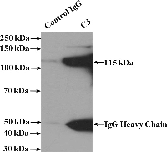IP Result of anti-C3 (IP:Catalog No:108718, 4ug; Detection:Catalog No:108718 1:1000) with human plasma tissue lysate 4000ug.