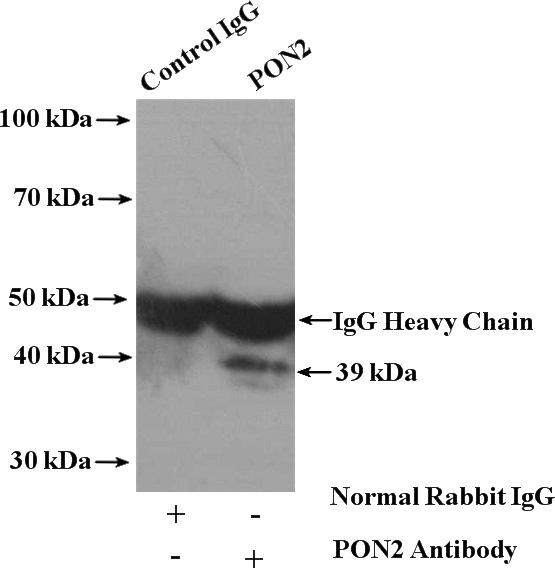 IP Result of anti-PON2 (IP:Catalog No:114059, 4ug; Detection:Catalog No:114059 1:500) with L02 cells lysate 3200ug.