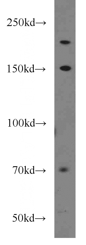 HeLa cells were subjected to SDS PAGE followed by western blot with Catalog No:116532(UBE2O antibody) at dilution of 1:500