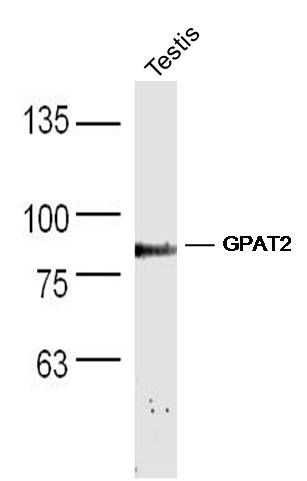 Fig1: Sample: Testis (Mouse) Lysate at 40 ug; Primary: Anti-GPAT2 at 1/300 dilution; Secondary: IRDye800CW Goat Anti-Rabbit IgG at 1/20000 dilution; Predicted band size: 88 kD; Observed band size: 88 kD
