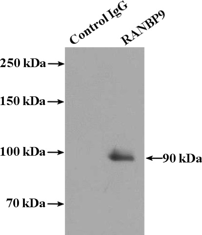 IP Result of anti-RANBP9 (IP:Catalog No:114540, 4ug; Detection:Catalog No:114540 1:600) with HeLa cells lysate 1600ug.
