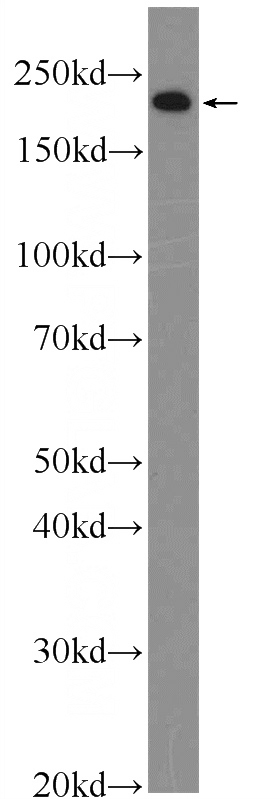 mouse embryo tissue were subjected to SDS PAGE followed by western blot with Catalog No:112933(MYH3 Antibody) at dilution of 1:1000