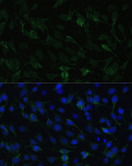 Immunofluorescence - TAC1 Polyclonal Antibody 