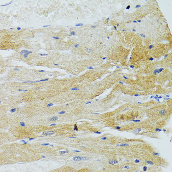 Immunohistochemistry - MOAP1 Polyclonal Antibody 