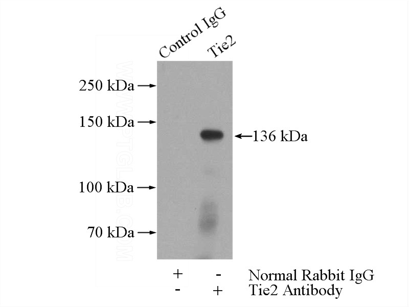 IP Result of anti-TEK (IP:Catalog No:116123, 4ug; Detection:Catalog No:116123 1:500) with mouse lung tissue lysate 4000ug.