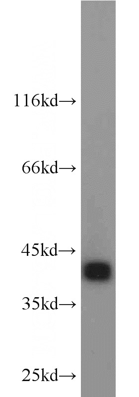 L02 cells were subjected to SDS PAGE followed by western blot with Catalog No:107823(ACAA1 antibody) at dilution of 1:1000
