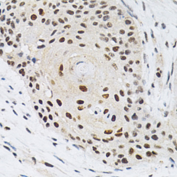 Immunohistochemistry - KPNA4 Polyclonal Antibody 